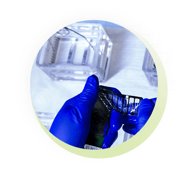 Inherited Monogenic Disorders