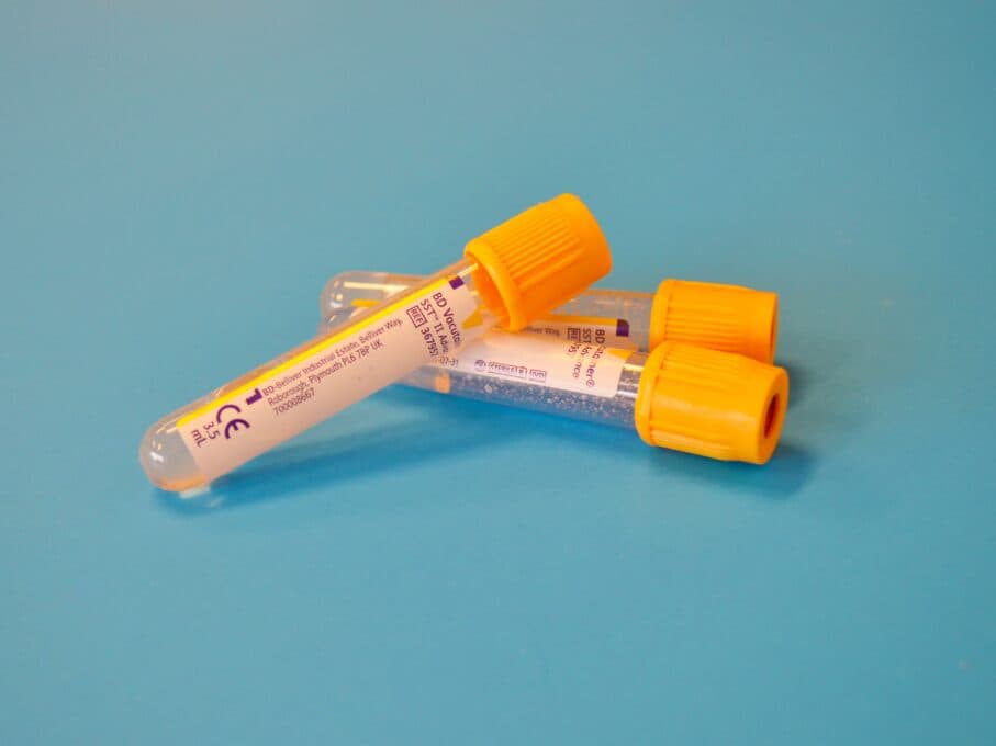 DNA Test Kit: How to Perform a DNA Test at Home In Nigeria